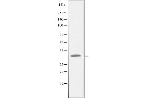 Western blot analysis of extracts from Jurkat cells using PITX1 antibody. (PITX1 antibody  (Internal Region))