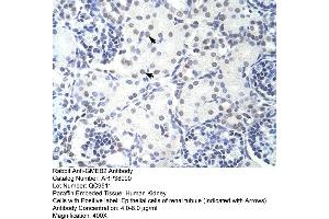Human kidney (GMEB2 antibody  (C-Term))