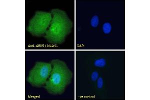 ABIN570930 Immunofluorescence analysis of paraformaldehyde fixed U2OS cells, permeabilized with 0. (NUAK1 antibody  (Internal Region))