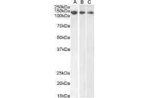 ABIN184570 (1µg/ml) staining of HeLa (A), HepG2 (B) and Jurkat (C) lysate (35µg protein in RIPA buffer). (DDB1 antibody  (C-Term))
