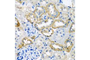 Immunohistochemistry of paraffin-embedded rat kidney using UQCR10 antibody at dilution of 1:100 (x40 lens). (UQCR10 antibody)