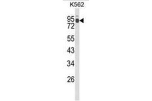 Western blot analysis of IL1RAPL2 Antibody (Center) in K562 cell line lysates (35ug/lane). (IL1RAPL2 antibody  (Middle Region))