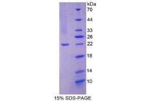 SDS-PAGE (SDS) image for Nitric Oxide Synthase 2, Inducible (NOS2) (AA 533-696) protein (His tag) (ABIN2126093)