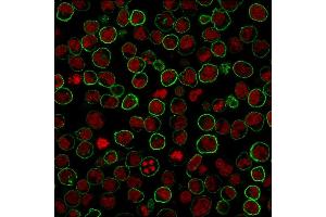 Immunohistochemistry (IHC) image for anti-Protein tyrosine Phosphatase, Receptor Type, C (PTPRC) antibody (ABIN6940470)