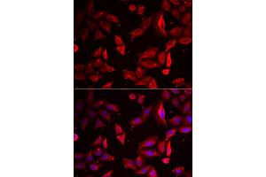 Immunofluorescence analysis of HeLa cell using SERPINB9 antibody.