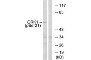 Western blot analysis of extracts from COS7 cells treated with TNF 20ng/ml 5', using GRK1 (Phospho-Ser21) Antibody. (GRK1 antibody  (pSer21))