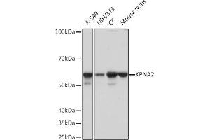 Western blot analysis of extracts of various cell lines, using KPN Rabbit mAb (ABIN1680520, ABIN3019328, ABIN3019329 and ABIN7101751) at 1:1000 dilution. (KPNA2 antibody)
