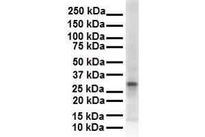 WB Suggested Anti-ECHDC2 antibody Titration: 1 ug/mL Sample Type: Human 721_B (ECHDC2 antibody  (Middle Region))