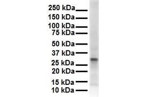 WB Suggested Anti-ECHDC2 antibody Titration: 1 ug/mL Sample Type: Human 721_B
