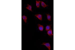 ABIN6265621 and ABIN6272881 staining HepG2 by IF/ICC. (TMPRSS4 antibody  (Internal Region))