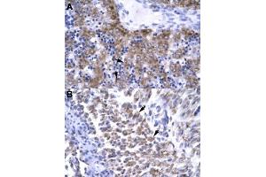 Immunohistochemical staining (Formalin-fixed paraffin-embedded sections) of human liver (A) and human muscle (B) with ERCC8 polyclonal antibody  at 4-8 ug/mL working concentration.