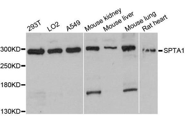 SPTA1 antibody  (AA 940-1160)