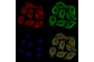 ABIN6260889 and ABIN6277320 staining Hela cells by IF/ICC.