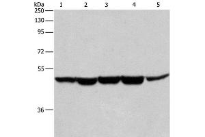 Western Blot analysis of Human bladder cancer tissue, A375, K562, Hela and HepG2 cell using HNRNP F Polyclonal Antibody at dilution of 1:350 (HNRNPF antibody)