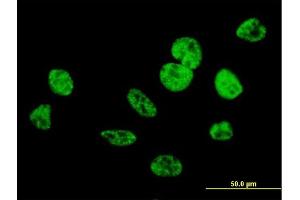 Immunofluorescence of purified MaxPab antibody to CIP29 on HeLa cell. (SARNP antibody  (AA 1-210))