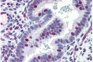Human Uterus (formalin-fixed, paraffin-embedded) stained with ERCC4 antibody ABIN364262 at 10 ug/ml followed by biotinylated anti-mouse IgG secondary antibody ABIN481714, alkaline phosphatase-streptavidin and chromogen. (ERCC4 antibody)