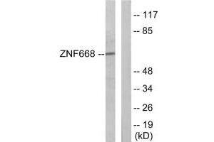 Western blot analysis of extracts from Jurkat cells, using ZNF668 antibody. (ZNF668 antibody)