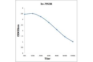 Antigen: 0. (AKR1A1 antibody  (AA 53-130))