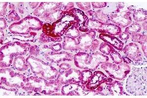 Human, Kidney: Formalin-Fixed Paraffin-Embedded (FFPE) (NPY1R antibody  (Extracellular Domain))