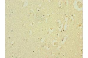 Immunohistochemistry of paraffin-embedded human brain tissue using ABIN7169927 at dilution of 1:100 (SCN8A antibody  (AA 1350-1440))