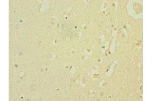 Immunohistochemistry of paraffin-embedded human brain tissue using ABIN7169927 at dilution of 1:100 (SCN8A antibody  (AA 1350-1440))