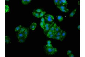 Immunofluorescence staining of HepG2 cells with ABIN7176574 at 1:133, counter-stained with DAPI. (GLI1 antibody  (AA 921-1106))