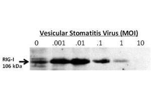 Image no. 1 for anti-DEAD (Asp-Glu-Ala-Asp) Box Polypeptide 58 (DDX58) (C-Term) antibody (ABIN357193) (DDX58 antibody  (C-Term))