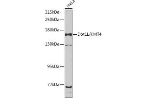 Western blot analysis of extracts of HeLa cells, using Dot1L/KMT4 antibody (ABIN6130312, ABIN6139776, ABIN6139780 and ABIN6223536) at 1:1000 dilution.