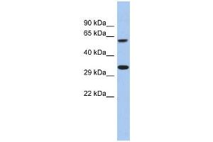FAM26A antibody used at 1 ug/ml to detect target protein.