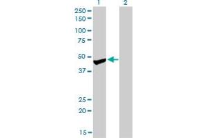 Western Blot analysis of PPM1F expression in transfected 293T cell line by PPM1F monoclonal antibody (M01), clone 2A9. (PPM1F antibody  (AA 1-100))