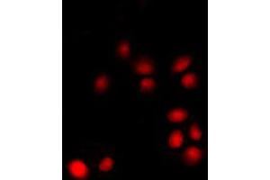 Immunofluorescent analysis of p14 ARF staining in K562 cells. (CDKN2A antibody  (Center))