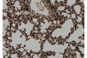 ABIN6273346 at 1/100 staining Mouse lung tissue by IHC-P. (WDR18 antibody  (Internal Region))