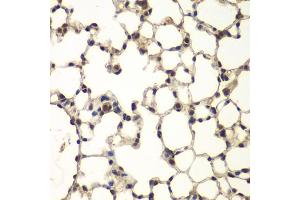 Immunohistochemistry of paraffin-embedded mouse lung using PHF11 antibody (ABIN6290738) at dilution of 1:100 (40x lens). (PHF11 antibody)