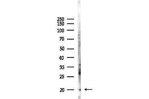 anti-HEN1/2 antibody