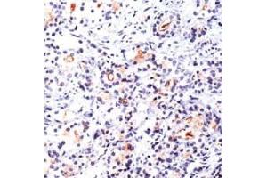 Image no. 1 for anti-Folate Hydrolase (Prostate-Specific Membrane Antigen) 1 (FOLH1) antibody (ABIN372967) (PSMA antibody)