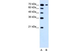 Western Blotting (WB) image for anti-Solute Carrier Family 5 (Low Affinity Glucose Cotransporter), Member 4 (SLC5A4) antibody (ABIN2462755)