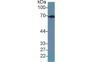Western blot analysis of Rat Liver lysate, using Rat KRT2 Antibody (1 µg/ml) and HRP-conjugated Goat Anti-Rabbit antibody ( (Keratin 2 antibody  (AA 508-685))