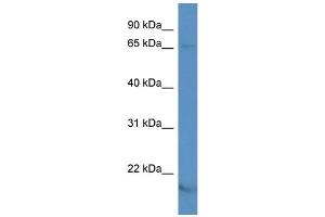 WB Suggested Anti-KCNA5 Antibody Titration: 1. (KCNA5 antibody  (N-Term))