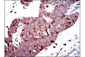 Immunohistochemistry (IHC) image for anti-PDZ Binding Kinase (PBK) antibody (ABIN969345)