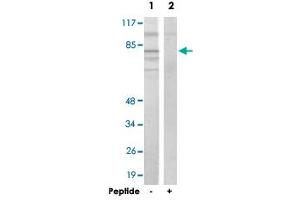 Western blot analysis of extracts from 293 cells, using ADD2 polyclonal antibody . (ADD2 antibody)