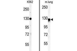 (LEFT) Western blot analysis of anti-VINC Antibody (N-term) in K562 cell line lysates (35ug/lane). (Vinculin antibody  (N-Term))