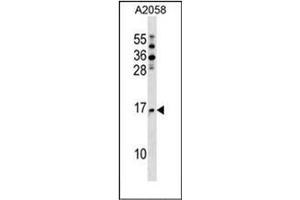 Western blot analysis of NAT5 Antibody (C-term) in A2058 cell line lysates (35ug/lane). (NAT5 antibody  (C-Term))