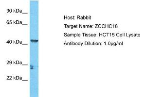 Host: Rabbit Target Name: ZCCHC18 Sample Tissue: Human HCT15 Whole Cell  Antibody Dilution: 1ug/ml (ZCCHC18 antibody  (C-Term))