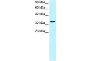Western Blotting (WB) image for anti-SMAD, Mothers Against DPP Homolog 6 (SMAD6) antibody (ABIN2460536) (SMAD6 antibody)