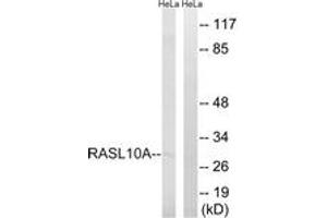Western Blotting (WB) image for anti-RAS-Like, Family 10, Member A (RASL10A) (AA 107-156) antibody (ABIN2890571) (RASL10A antibody  (AA 107-156))