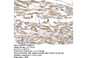 Human Muscle (KIFC2 antibody  (N-Term))