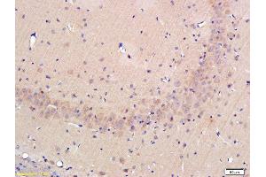 Formalin-fixed and paraffin-embedded rat hippocampus labeled with Rabbit Anti-OPN Polyclonal Antibody, Unconjugated (ABIN723800) at 1:300 followed by conjugation to the secondary antibody (Osteopontin antibody  (AA 221-280))