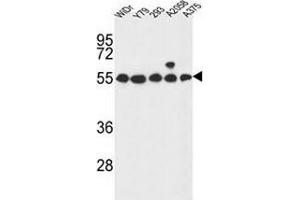 Western blot analysis in WiDr,Y79,293,A2058,A375 cell line lysates (35ug/lane) using GPR180/ITR Antibody .