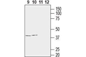 Western blot analysis of human T-cell leukemia (Jurkat) (lanes 9 and 11) and human neuroblastoma (SH-SY5Y) (lanes 10 and 12) cell line lysates: - 9,10. (Connexin 43/GJA1 antibody  (C-Term, Intracellular))