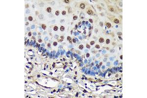 Immunohistochemistry of paraffin-embedded Human esophageal using FCF1 Rabbit pAb (ABIN7267162) at dilution of 1:100 (40x lens). (FCF1 antibody)